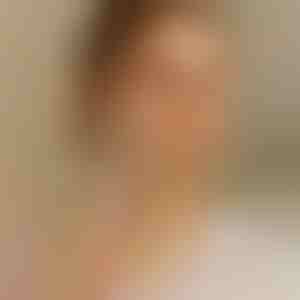 Arcszőrzet eltávolító epilátor | EPISLIK